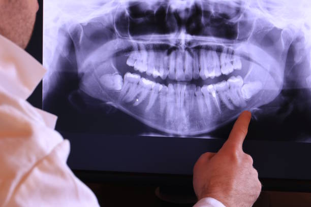 Best Dentist for Tooth Abscess  in Dodson Branch, TN