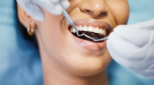 Best Dentist for Severe Toothache  in Dodson Branch, TN
