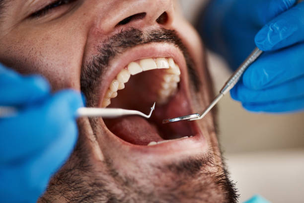 Best Cracked Tooth Emergency Dentist  in Dodson Branch, TN