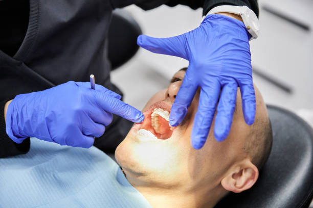 Best Knocked-Out Tooth Emergency  in Dodson Branch, TN